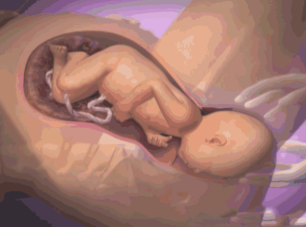 Тонус (гипертонус) матки при беременности: симптомы на 1,2,3 триместре