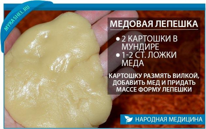 Сухой кашель у ребенка