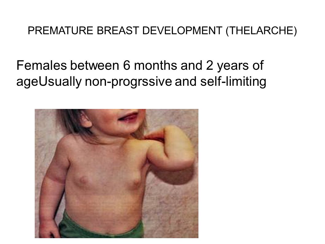 Когда, в каком возрасте начинает расти грудь у девочек? как понять, что грудь растет: признаки и стадии роста грудных желез у девочек в картинках
