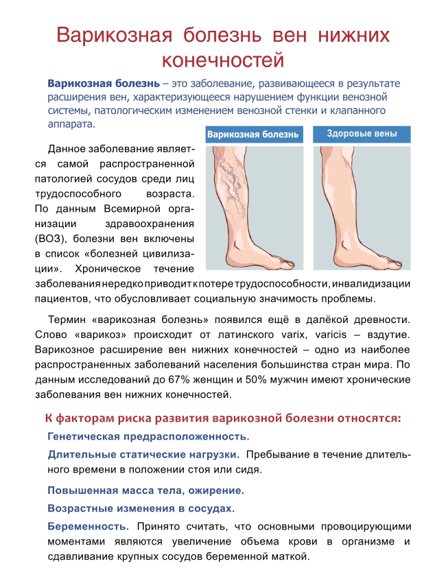 Отеки
