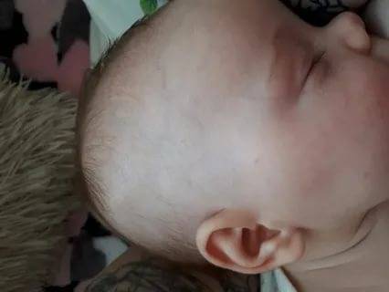 Выпадают волосы у новорожденных на голове | уроки для мам