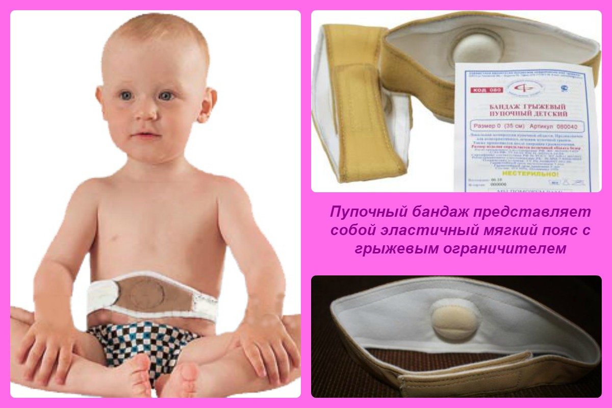 Виды и применение бандажа и пояса для пупочной грыжи для новорожденных