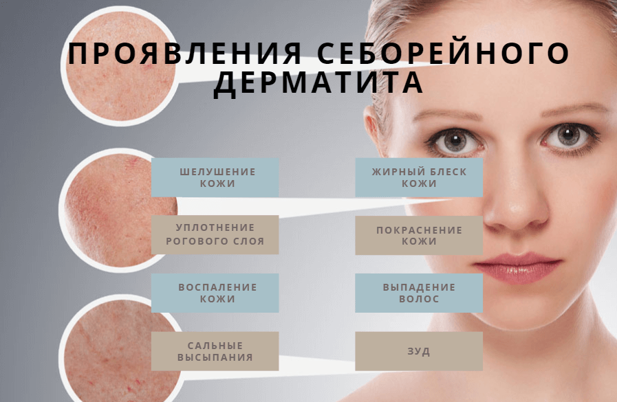 Детские болезни с высыпаниями на коже | заболевания кожи у детей до года