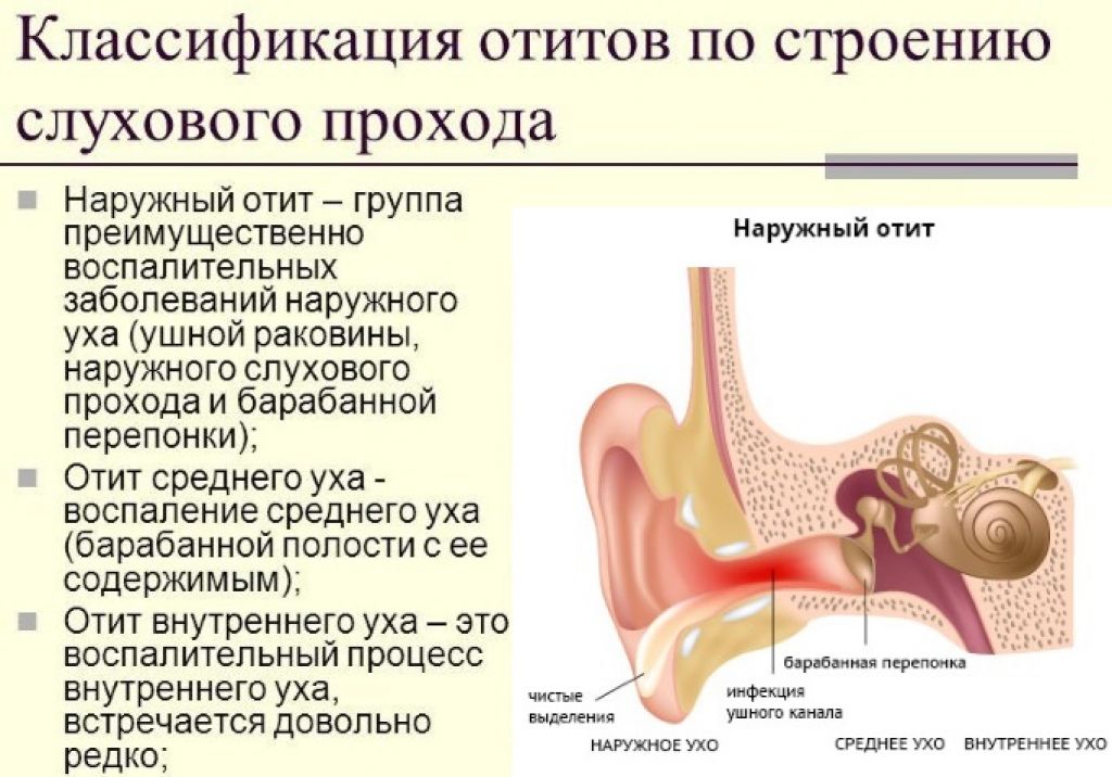 Экссудативный средний отит. лечение отита среднего уха у ребенка