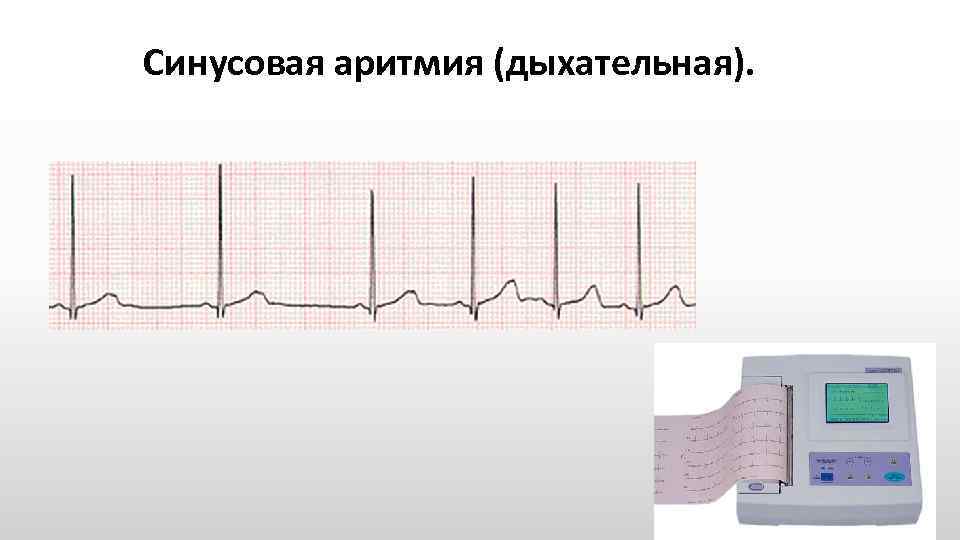 Топ-5 признаков, что нужно обращаться к детскому кардиологу