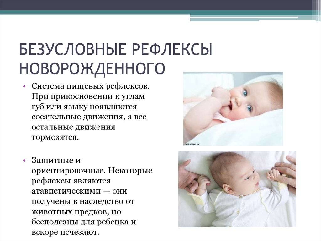 Эффект моро у младенцев до какого возраста
