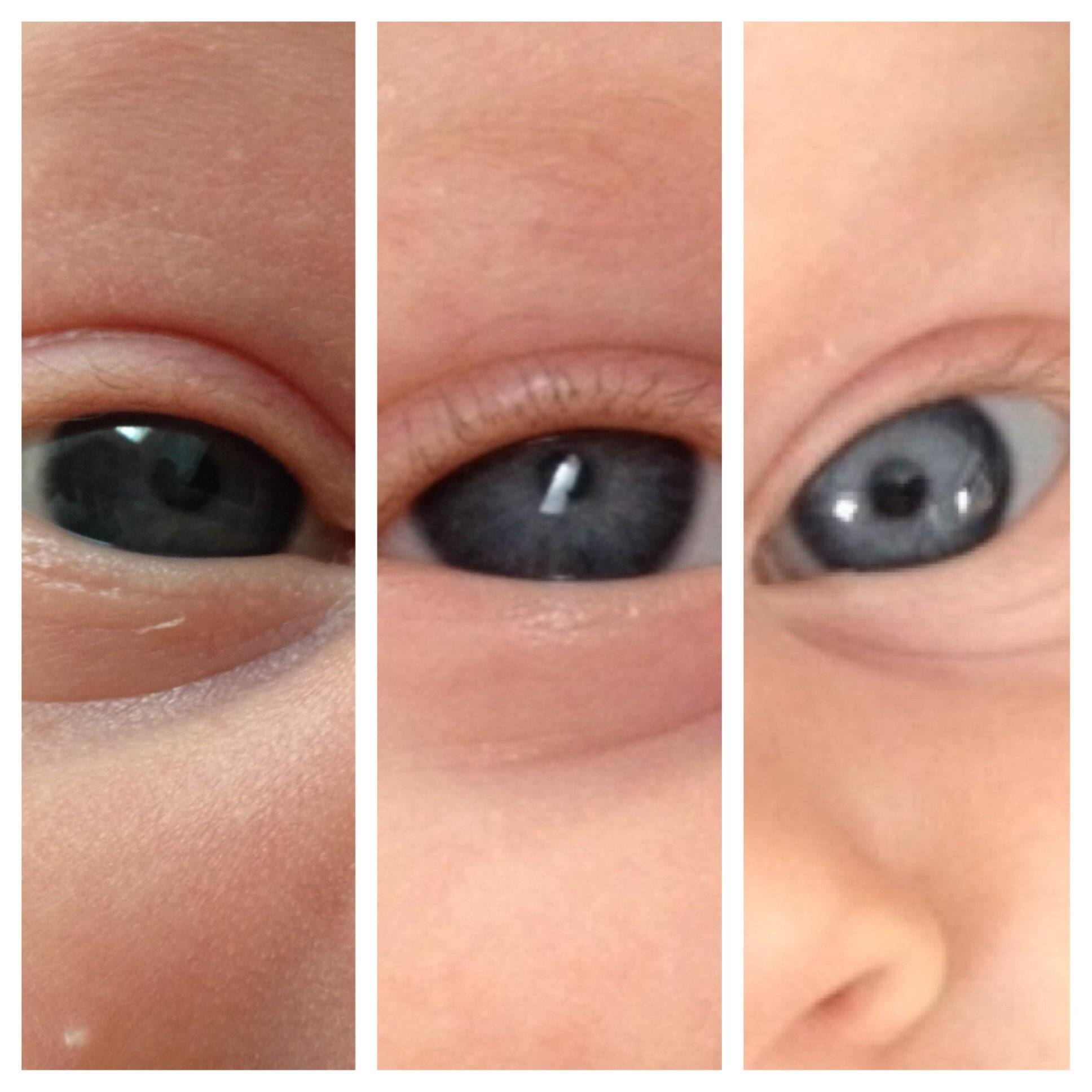 Когда и почему у ребенка меняется цвет глаз