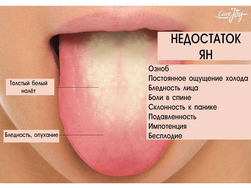 Глоссит - лечение, симптомы, причины - smile4you.ru
