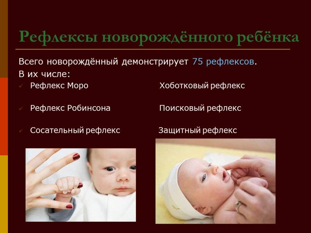 Рефлексы новорожденных презентация, доклад