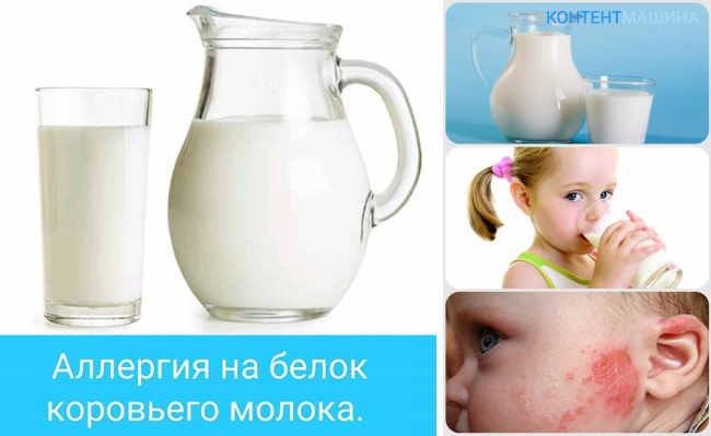 Аллергия на молоко