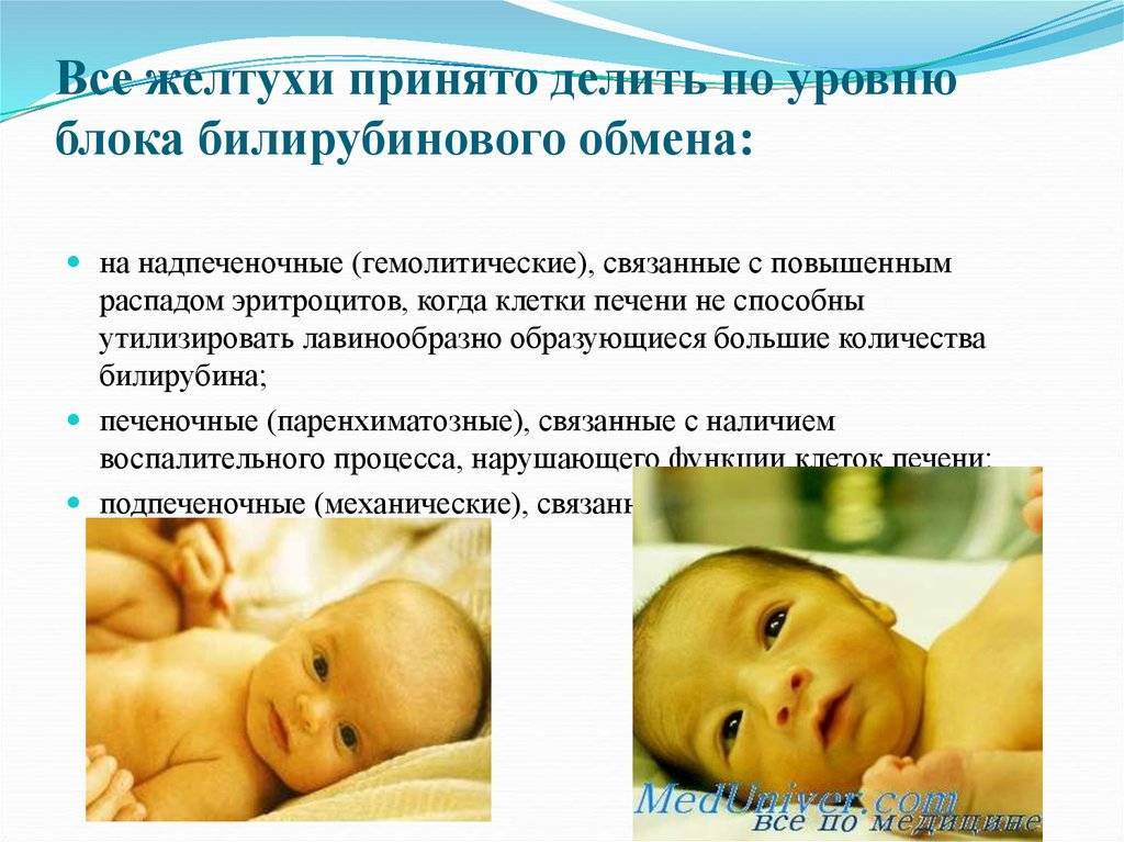 Послеродовая желтуха у новорожденных: особенности и лечение