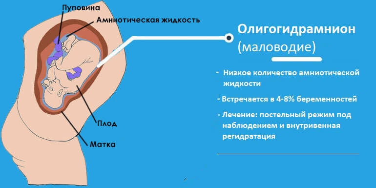 Водная среда. все об околоплодных водах