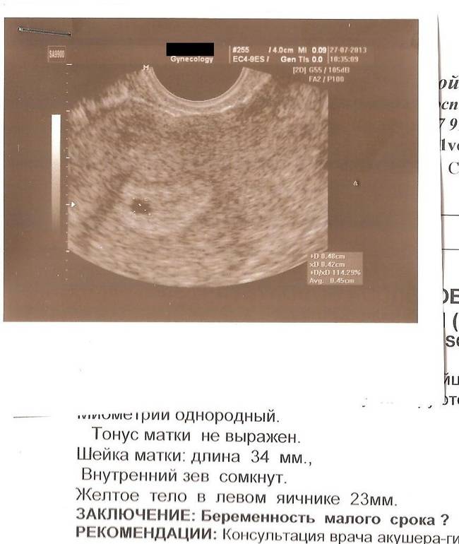 Когда виден эмбрион в плодном яйце. Размеры матки при беременности 5 недель по УЗИ. УЗИ матки на ранних сроках беременности. УЗИ матки на 3 недели беременности. Размер матки на 5 неделе беременности по УЗИ норма.