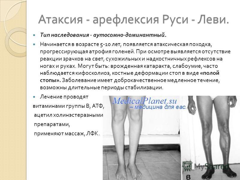 Шарко мари тута болезнь где лечат. наследственная невропатия шарко-мари-тута: возможности нефармакологического лечения