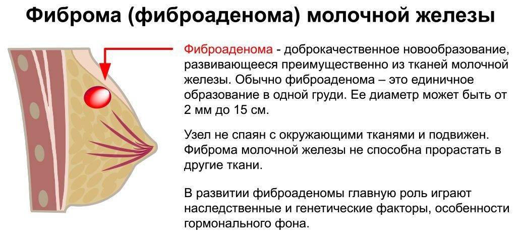 У ребенка уплотнение в молочной железе: грудные дети и подростки | parnas42.ru