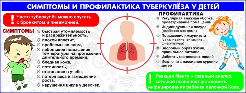 О ранних признаках и 12 клинических формах туберкулеза у детей рассказывает кандидат медицинских наук