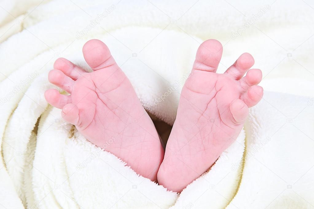 Потница у новорожденного ребенка: как выглядит (фото) – эл клиника