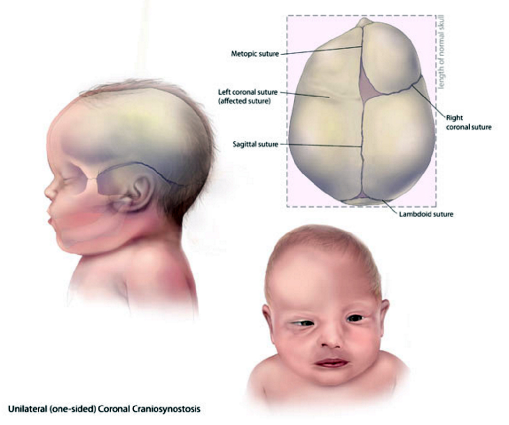 Почему у новорожденного нет волос на передней части головы