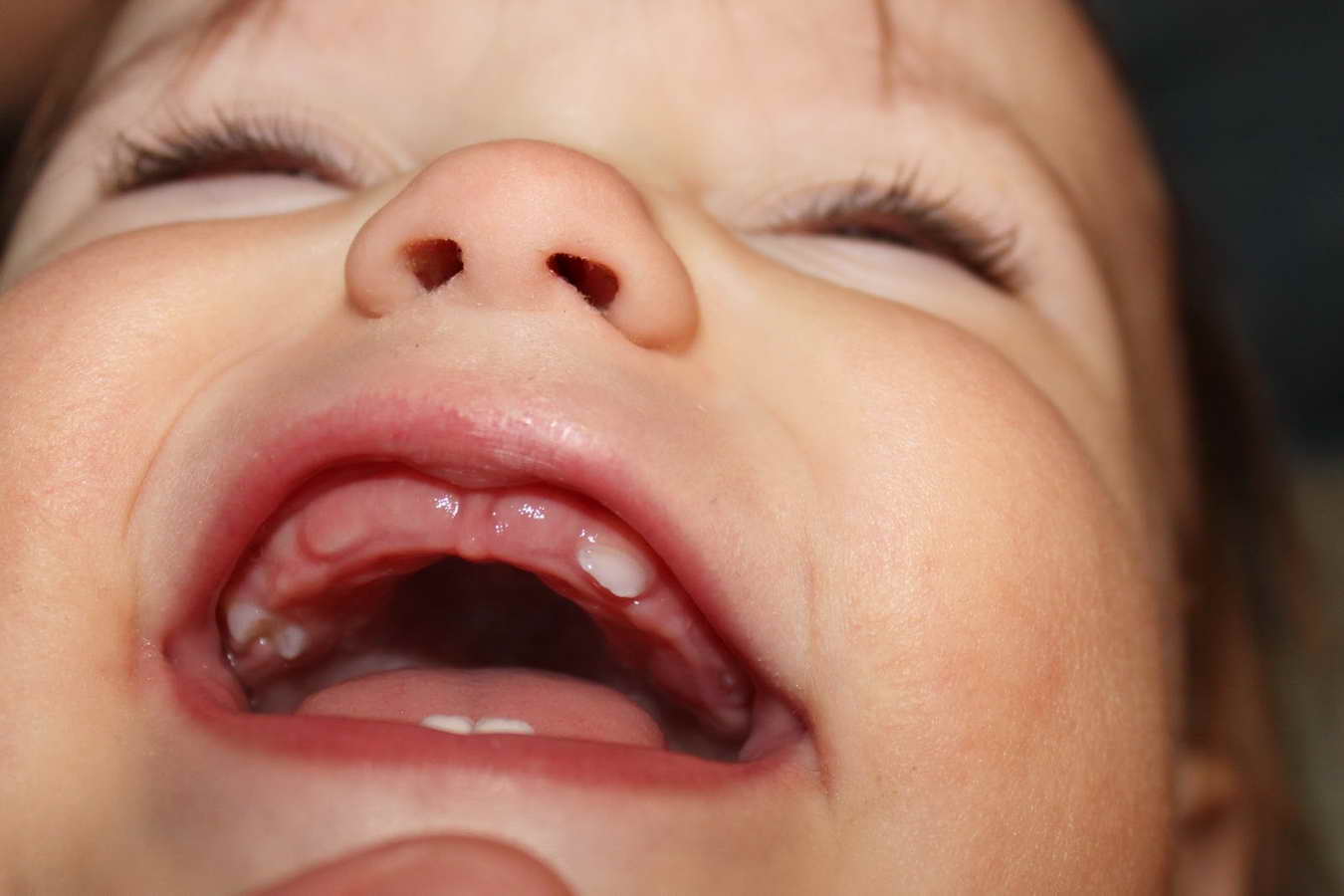 Прорезывание зубов у детей до года, все нюансы, порядок, сроки.