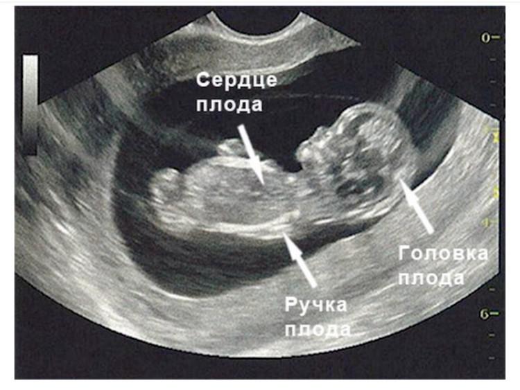 11 неделя беременности описание и фото — евромедклиник 24