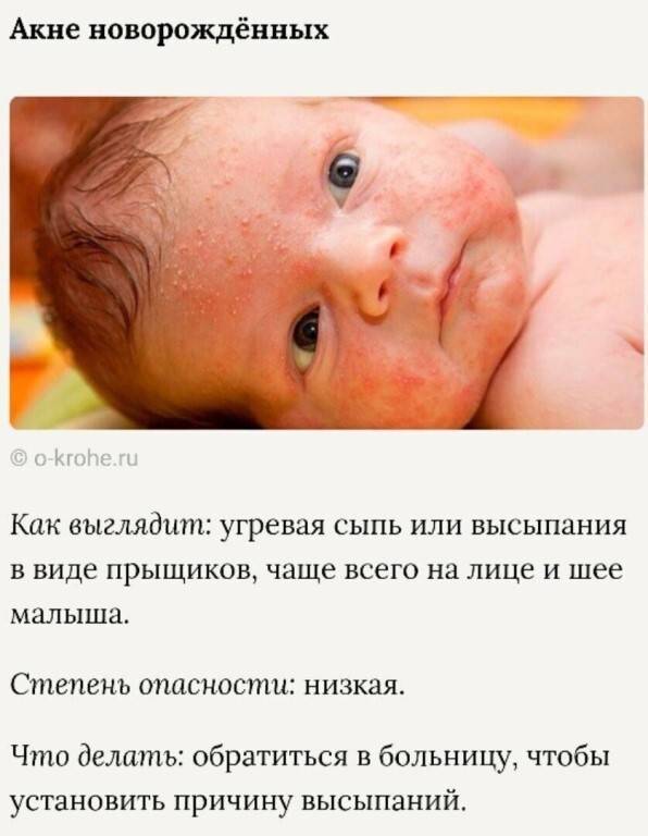 Прыщи у грудничков на лице: причины сыпи у новорожденных, лечение высыпаний у грудничков - детская поликлиника клин