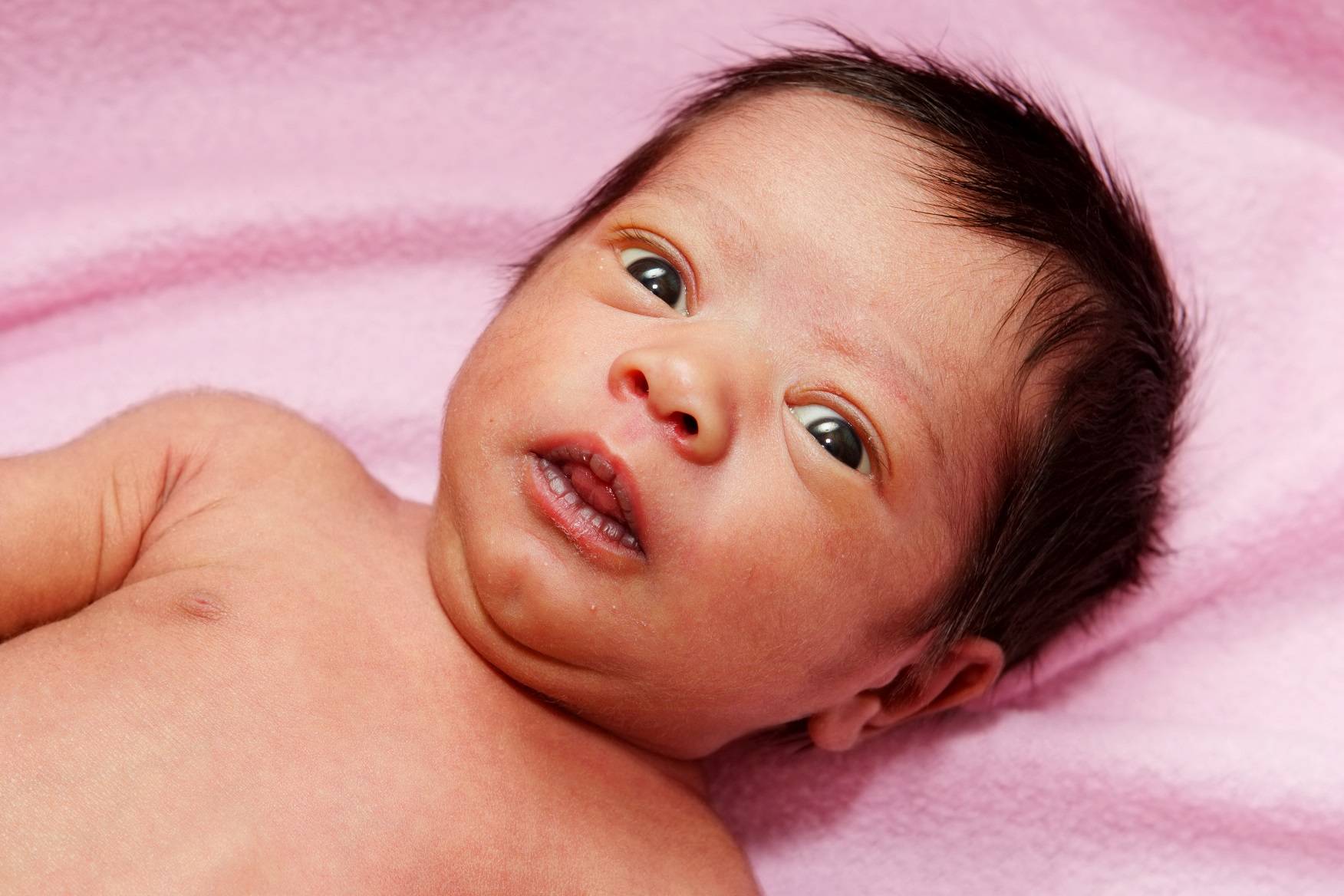 Возрастные особенности кожи детей первого года жизни