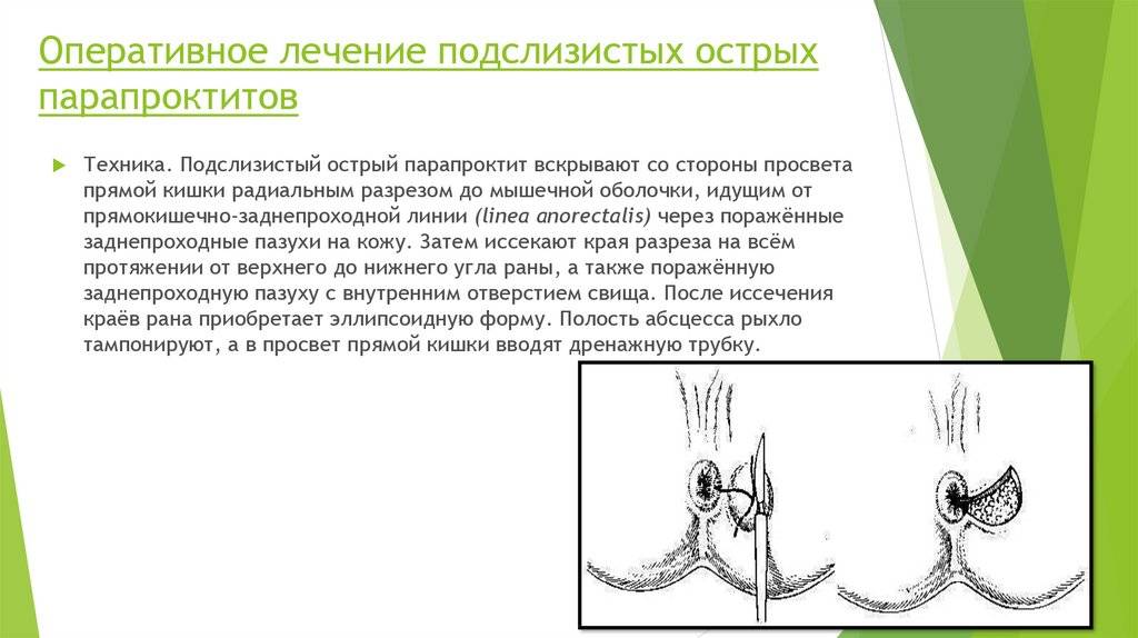 Симптомы и причины парапроктита у детей: лечение без операции и хирургическое