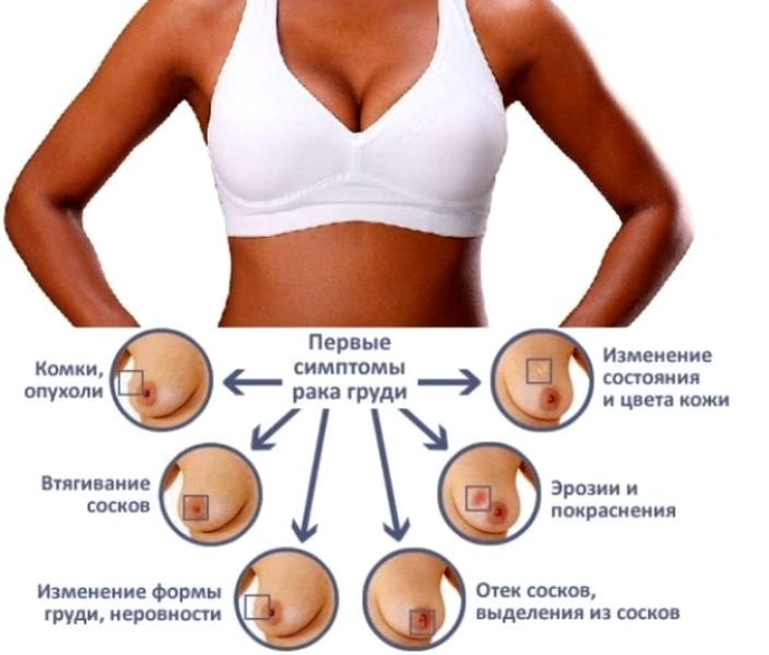 Мастит: проблемы с кормлением — срочно бегите к маммологу