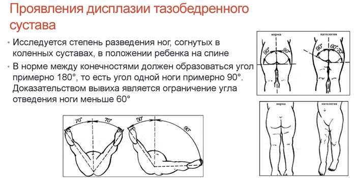 Психосоматика дисплазии