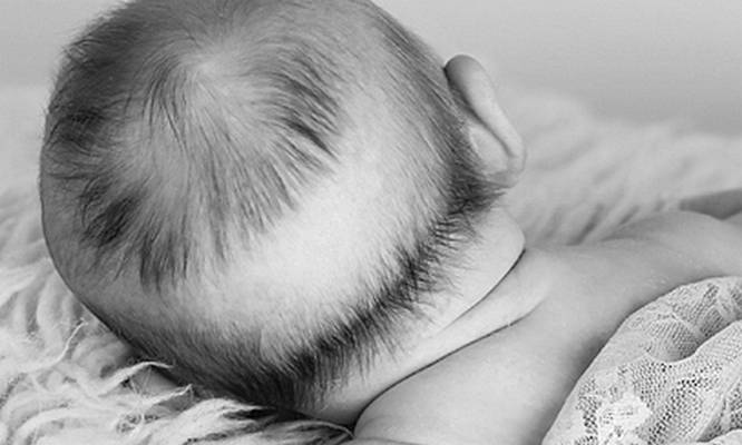 Себорея на голове у детей: причины, лечение, шампунь