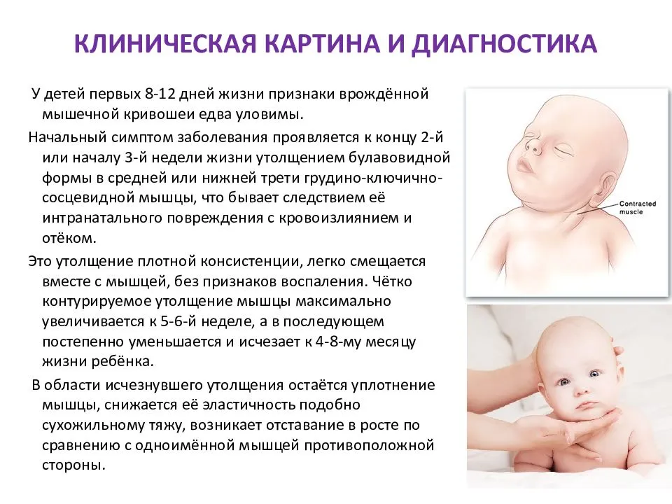 Зрение новорожденного: этапы развития до года