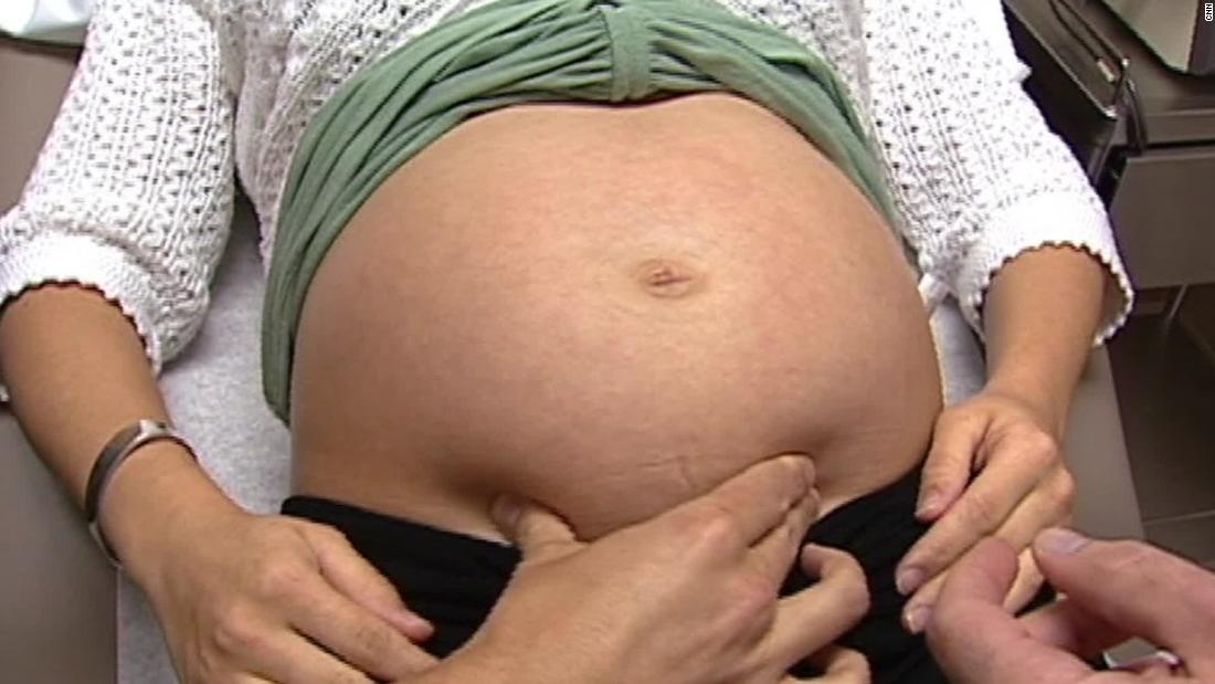 41 неделя беременности: что происходит с малышом и мамой, почему не начинаются роды, способы стимуляции, фото живота и узи, видео