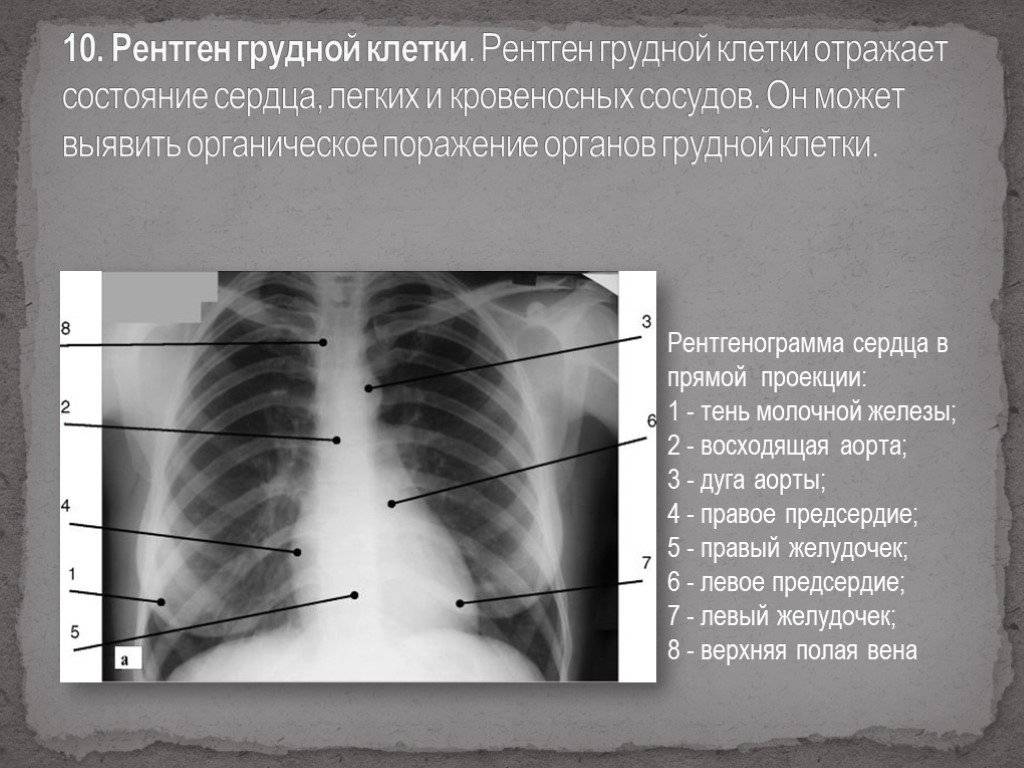 Рентген грудной клетки. показания и противопоказания. методика проведения. описание рентгенографии здоровой грудной клетки