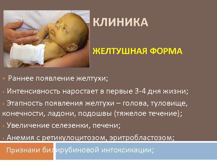 Гемолитическая болезнь новорождённых