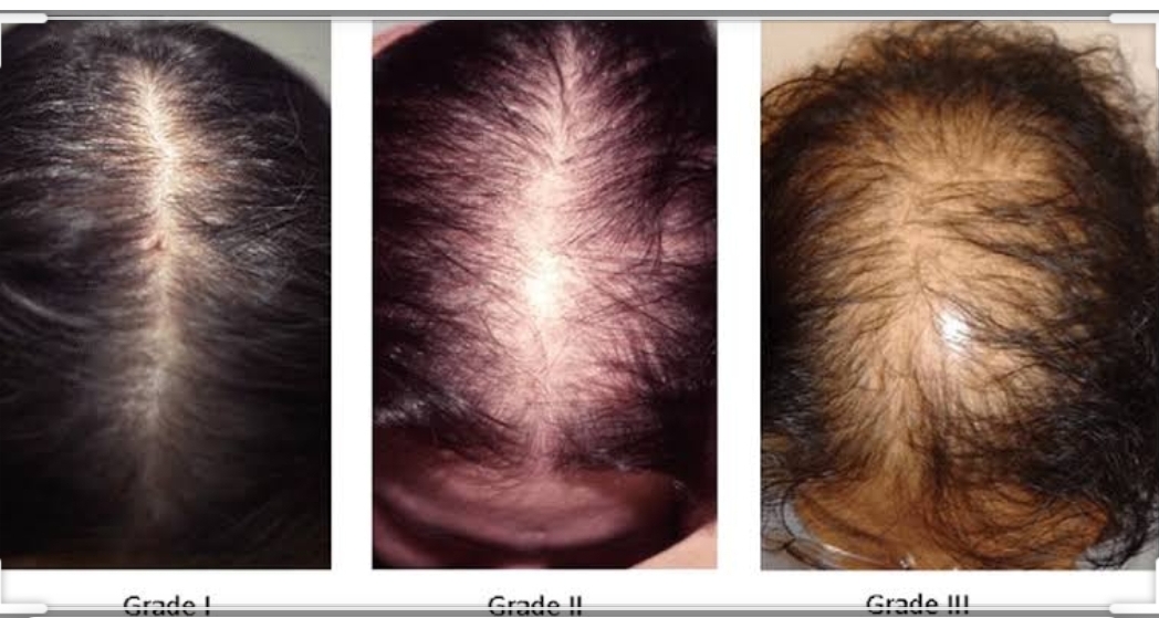 На что может влиять рост волос на голове
