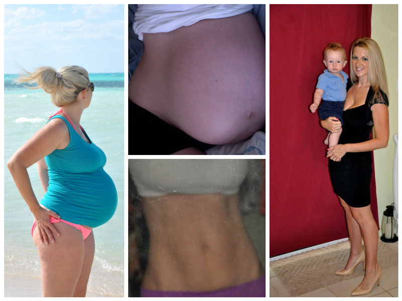 Во время и после беременности фото