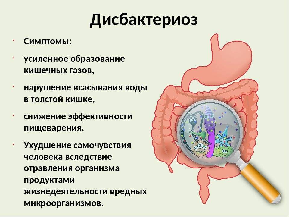 Дисбактериоз кишечника: симптомы, лечение, диета