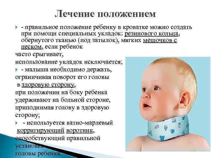 Кривошея - причины, признаки, методы лечения. кривошея у новорожденных