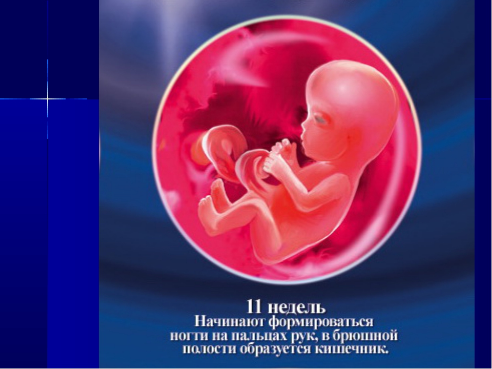 11 неделя беременности