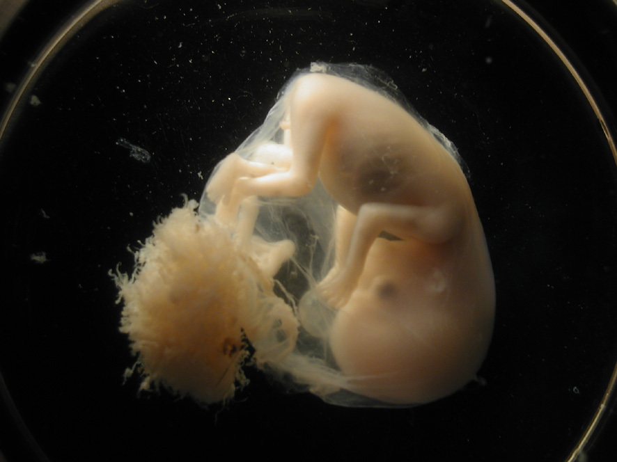 9 неделя беременности: развитие размер плода, что происходит фото узи живота
