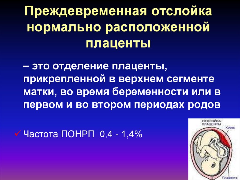 Диагностика поздних сроков беременности акушерство презентация