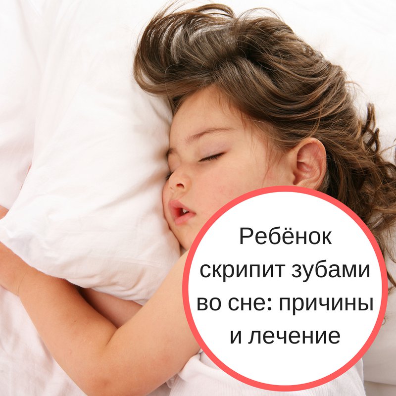 Почему ребенок ночью скрипит зубами: причины и последствия бруксизма