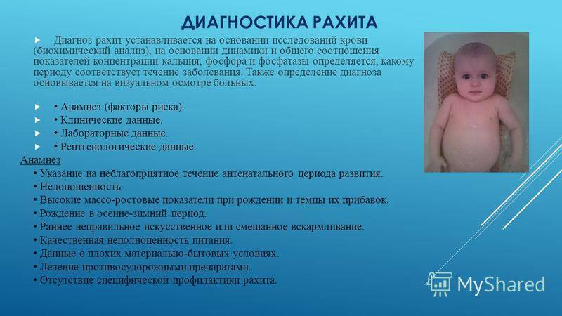 Рахит у ребенка. лечение и профилактика