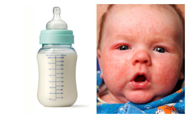Аллергия у младенцев при грудном вскармливании — семейная клиника опора г. екатеринбург