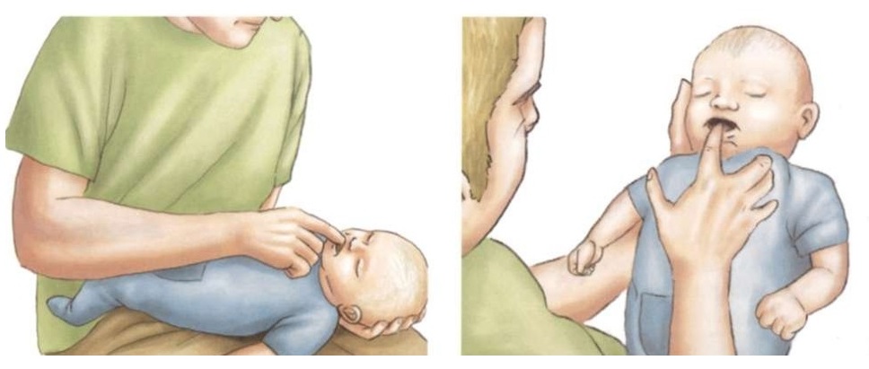 Ребенок давится и захлебывается при кормлении грудным молоком: почему это происходит и что делать с новорожденным грудничком 
