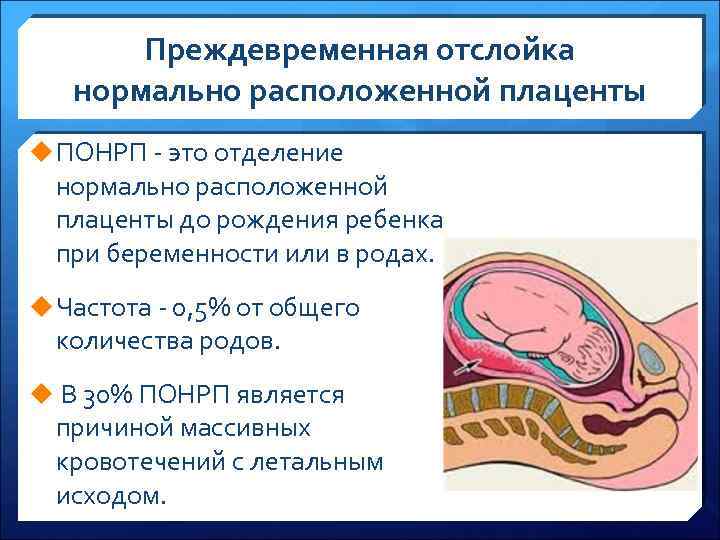 Отслойка плаценты фото выделений