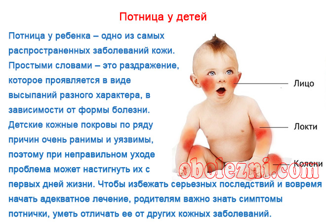 Акне новорожденных (прыщи): лечение и как не спутать с аллергией