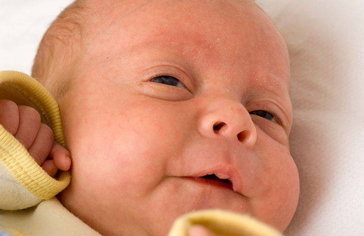 Ребенок спит с открытыми глазами: почему это бывает