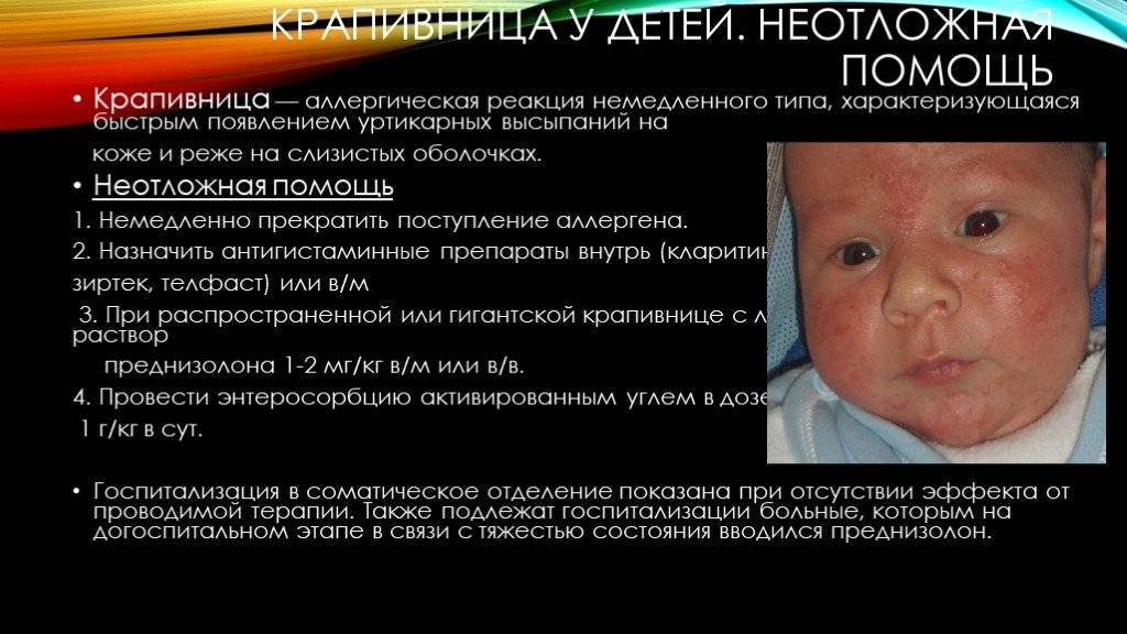У малыша поднялась температура: как себя вести родителям | университетская клиника