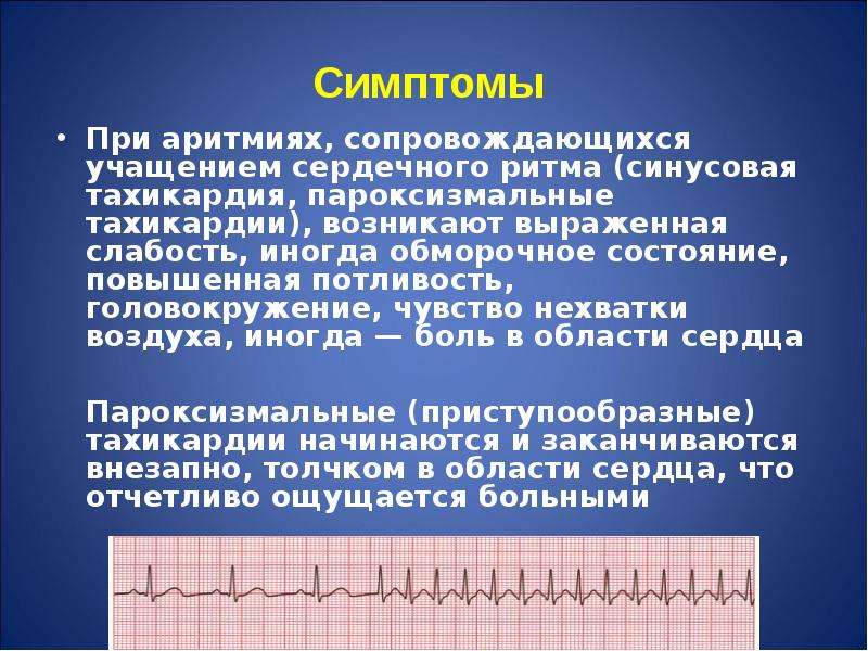 Нарушения ритма сердца (аритмии)